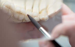 Anfertigung von hochwertigem Zahnersatz in der Zahnarztpraxis Zieglgänsberger, Dietzenbach, Kreis Offenbach, Hessen